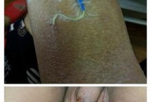 魏则西（魏则西离世、事件背后的真相以及对医疗体系的探讨）